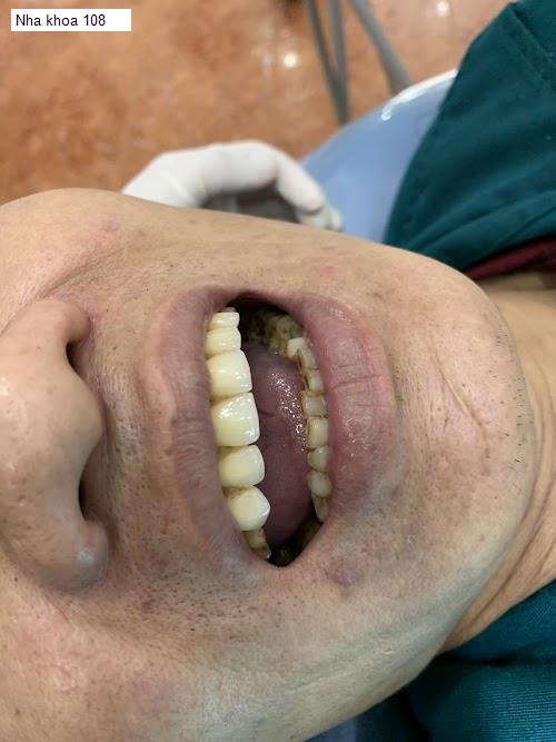 Hình ảnh Nha khoa 108
